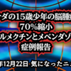 ◆15歳少年の脳腫瘍が70％縮小──イベルメクチンとメベンダゾール症例報告の全記録