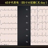 ECG-299：answer