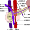 Celiac artery compression syndrome（正中弓状靭帯圧迫症候群）について