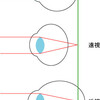 遠視鏡と老眼鏡の違いについて