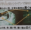 当院の超音波検査について【１】