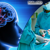 Things To Consider Before Choosing The Right Neurosurgery Services
