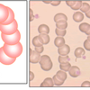 赤血球連銭のメカニズム