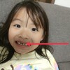 折れた前歯が生えてきたよ！７歳娘３年ぶり良かったね。