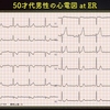 ECG-211：50才男性。ERにて。