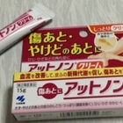 アットノンで色素沈着は治るの 今日のたっくん アットノンで色素沈着は治るの 今日のたっくん