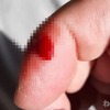 【DIY】2階に小さな換気扇が1個しか無いから自分で・・・ 指を切っておしまい！