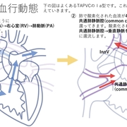 無名 静脈