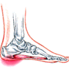 Simple Methods To Prevent Posterior Calcaneal Spur