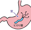 ピロリ菌一次除菌を二回やることになった原因は、お酒？タバコ？