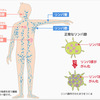 悪性リンパ腫に関する雑学