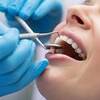 How to Prevent the Yellowing of Your Teeth