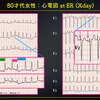 ECG-341：answer