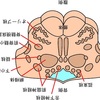 椎骨動脈解離でなぜ吃逆が出るのか？