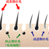 エステサロン脱毛の効果！良いとこ悪いとこと人気店