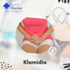 Klamidia