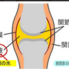 膝に水が溜まっているか確認する方法。