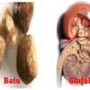 Cara menghilangkan batu ginjal secara alami
