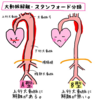 大動脈解離の患者さんが入院してきた①