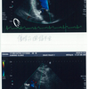 心エコー検査してきました