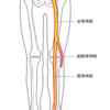 坐骨神経痛　part１　