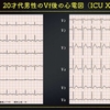 ECG-236：20才代男性。いびきをかいて、心肺停止でした。