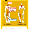 足底板で負担を減らせ。膝内転モーメントに対する外側足底板効果