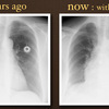 ECG-131：answer