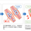 筋肉痛とは？原因について