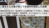 赤ちゃんの鼻が低いので、形成外科に行ってきた。【だんご鼻】