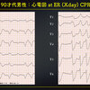 ECG-342：90才代男性。CPA搬入です。