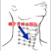 【頸部聴診】による嚥下機能評価-どんな嚥下音の時に何が起こっているか？