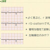 ECG-193:aswer