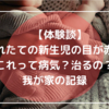 【体験談】生まれたての新生児の目が赤い！これって病気？治るの？我が家の記録。