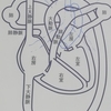 初めての妊娠、エコー検査で胎児に先天性心疾患【血管輪】