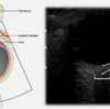 眼球エコーについて復習してみた。