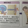 子供の腰痛の原因