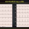 ECG-264：answer