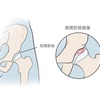 股関節唇とは？！