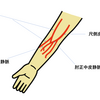 静脈血採血について