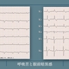 【ECG-403】90s woman： 心室ペーシング部位の推定です。