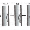 どうなったら梗塞になるのか？