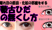 目頭切開ラインや二重メイクを邪魔する 蒙古ひだ を無くしてデカ目になろう かわいくなりたい