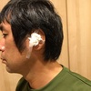 急性中耳炎 手術2日目