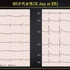 ECG-267：80才代女性。気分不良での搬入です。