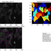 【CellProfiler】Transfluor Assayの画像データをCellProfilerで解析する