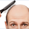 What to Choose- Wig or Hair Restoration Treatment?