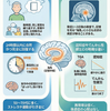 一過性全健忘（Transient Global Amnesia, TGA）とは