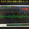 ECG-223：70才代 男性。｢Ｖfで息してるんですけど、どう解釈すればいいでしょうか？｣ 病棟で。