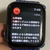 【Apple Watch SEでも】不整脈の通知が実際に来た話【心房細動】